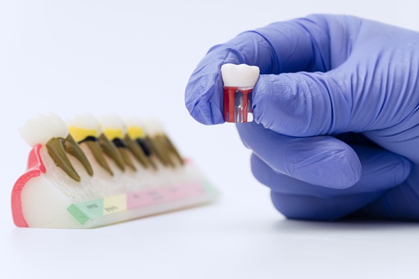 How Long Should My New Dental Crown Last?