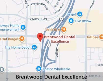 Map image for Wisdom Teeth Extraction in Brentwood, CA